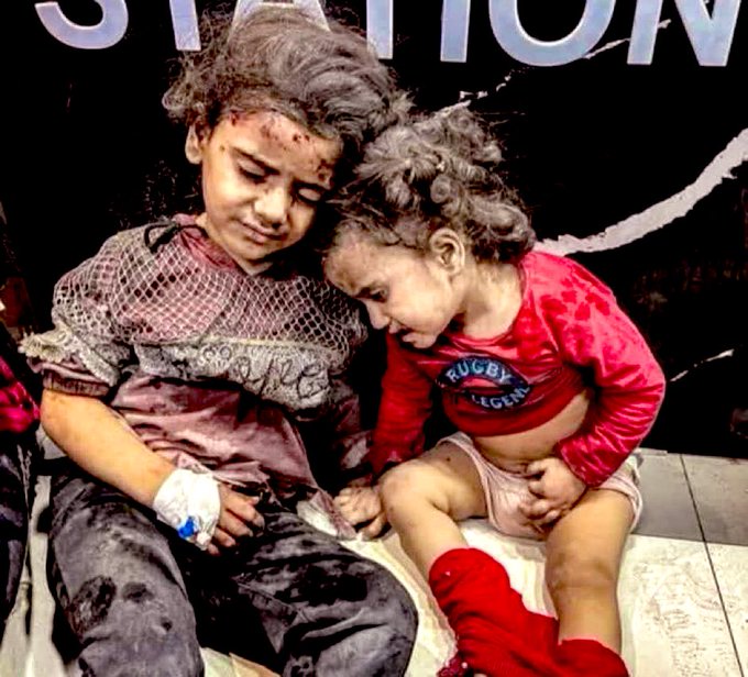 تصویر دردناک از دو  کودک زخمی در غزه+عکس