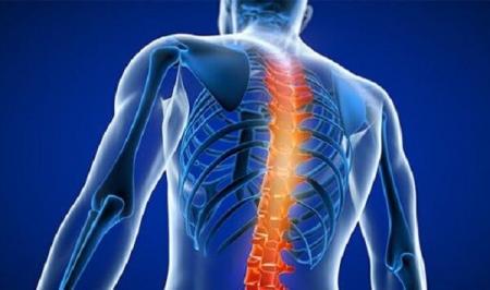دیابت نوع ۲ روی ستون فقرات و دیسک کمر هم تاثیر می‌گذارد؟