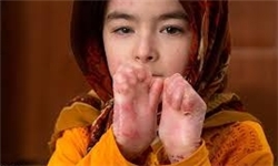 وقتی بیمارستان دولتی کودکان پروانه‌ای را جواب می‌کند