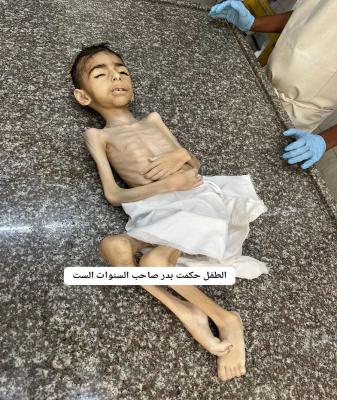 تصویر تکان دهنده از یک کودک اهل غزه قبل از شهادت