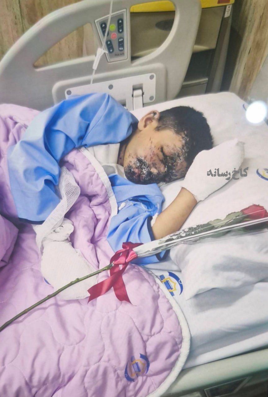  تصویری از جراحت کودک مظلوم لبنانی بر اثر انفجار پیجر