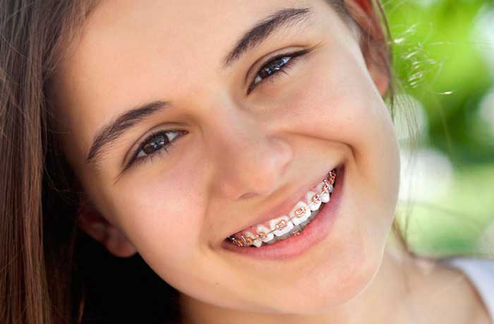سن طلایی برای انجام ارتودنسی 