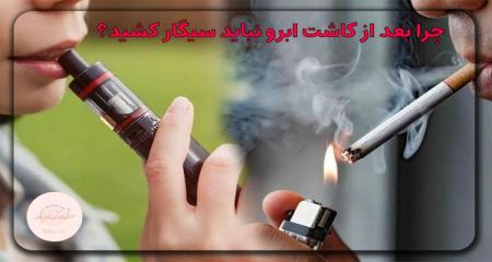 آگهی/ چرا نباید بعد از کاشت ابرو سیگار کشید؟