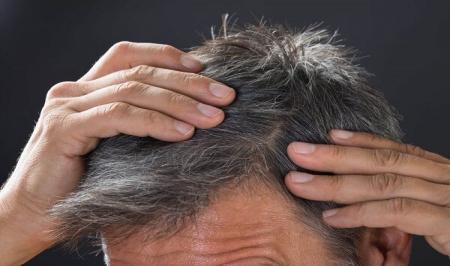 کمبود این ویتامین باعث سفید شدن موها می‌شود
