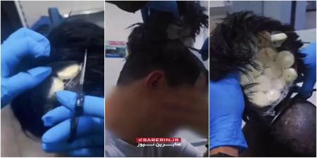 جاسازی کوکائین در کلاه‌ گیس یک فرد در کلمبیا