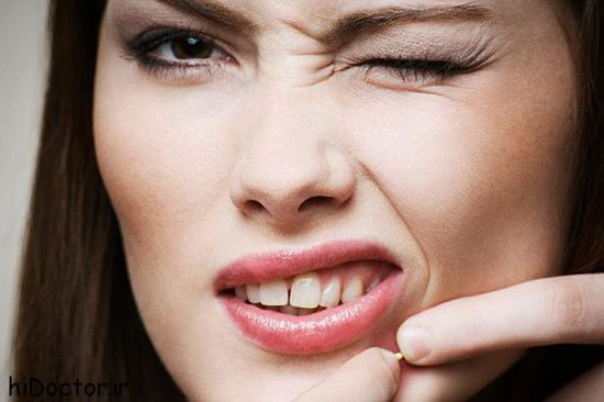  کاربردی‌ترین روش برای جلوگیری از جوش صورت