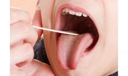 علت اصلی شکاف و ترک روی زبان چیست؟