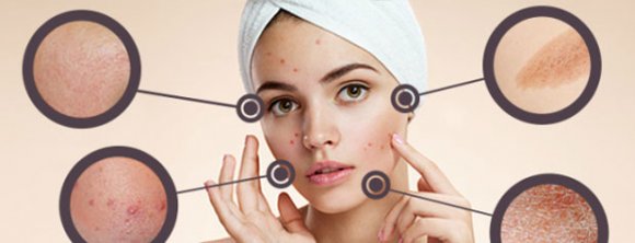 در چه مواردی باید به متخصص پوست مراجعه کنیم؟  