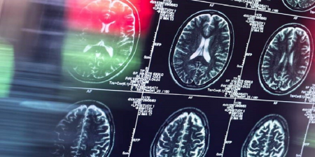  تأثیر عوامل روزانه بر شکل‌گیری عادت مغزی کشف شد