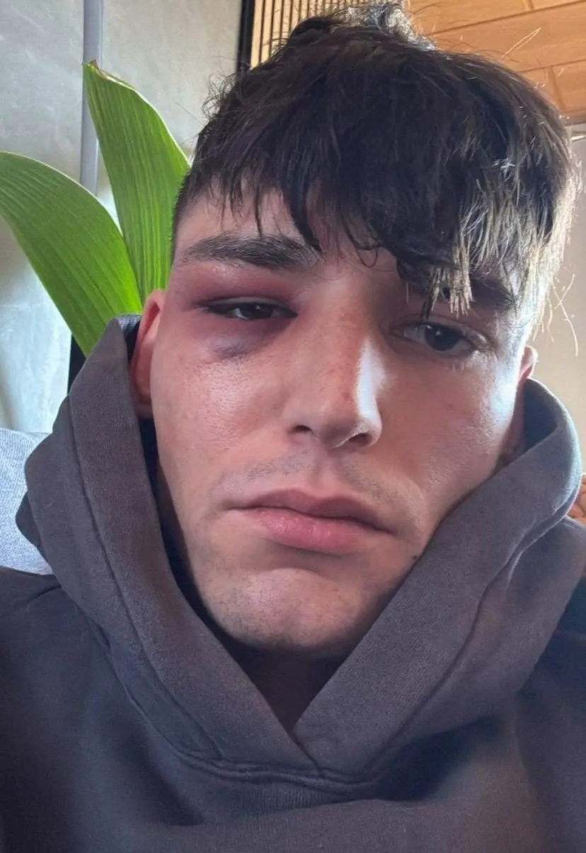 حمله به داوری که در استادیوم خواستگاری کرد!+عکس