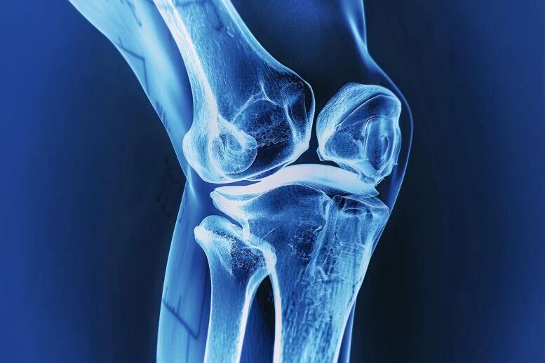 با عفونت و سرطان استخوان چگونه مقابله کنیم؟