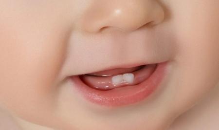 بعد از وارد شدن ضربه به زیر چانه کودکان این گونه از دندان‌های شیری و دائمی شان مراقبت کنید