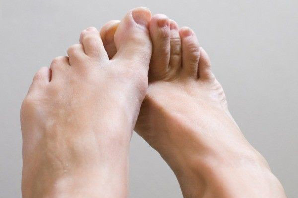 علل تعریق زیاد پاها /اینفوگرافیک