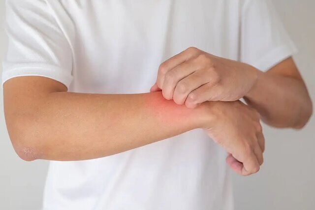 هشدار طب سنتی: افزایش مشکلات پوستی در فصل بهار