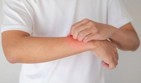 هشدار طب سنتی: افزایش مشکلات پوستی در فصل بهار