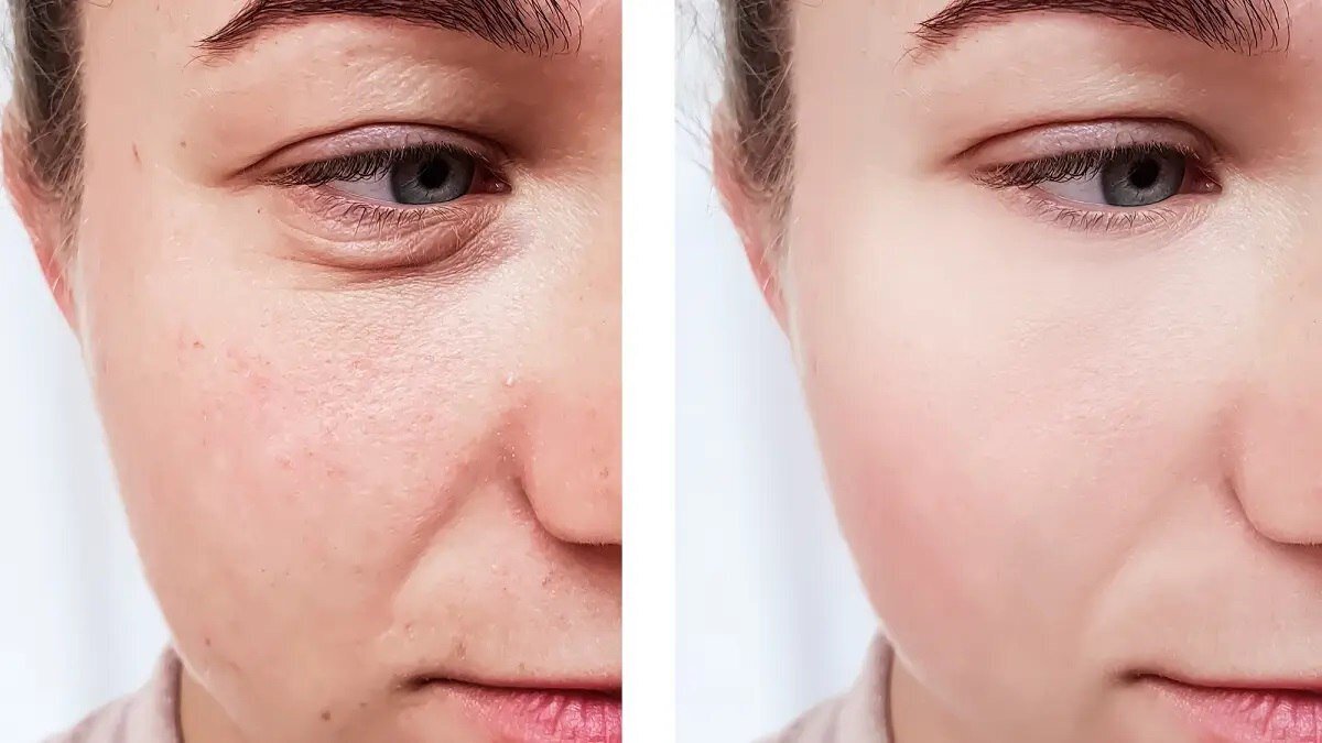 چگونه با چند ماسک ساده پوست خشک خود را تمیز و مرطوب کنیم؟
