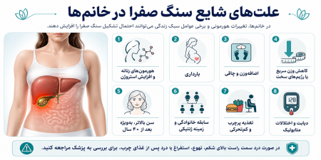 آگهی/ افزایش ابتلا به سنگ صفرا در زنان تهرانی