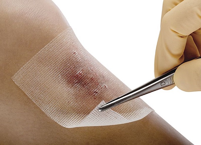  مقابله با درمانگران زخم بدون مجوز 