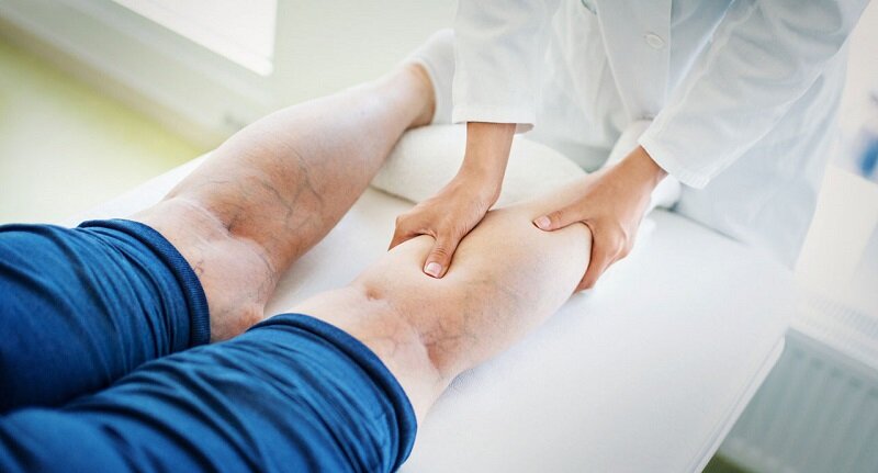 نشستن و ایستادن طولانی واریس را دعوت می‌کند؛ پزشکان چه می‌گویند؟
