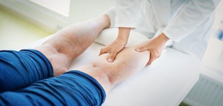 نشستن و ایستادن طولانی واریس را دعوت می‌کند؛ پزشکان چه می‌گویند؟
