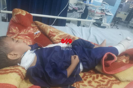  کودکی که در  حملات امروز آمریکا به تپه الله اکبر بندرعباس مجروح شد+ عکس