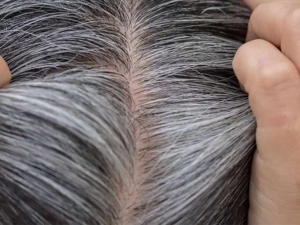 ۷ ترفند علمی و مهم برای خداحافظی با موهای سفید