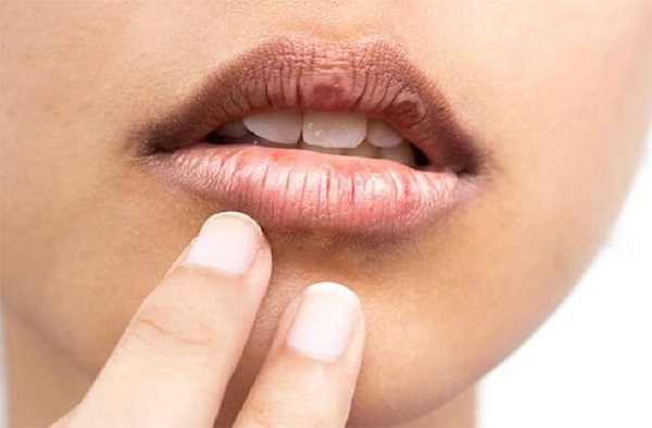 اگر صبح با لب های متورم بیدار می شوید این علامت را نادیده نگیرید