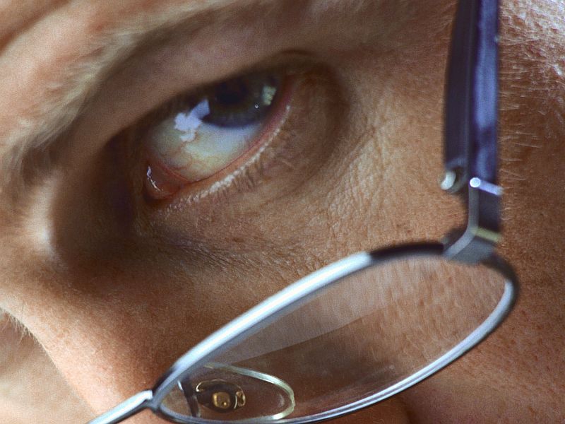  مکمل‌های ترکیبی و حفظ بینایی در انحطاط ماکولا
