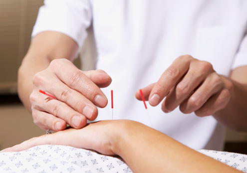 کاربرد طب سوزنی در صدمات ورزشی