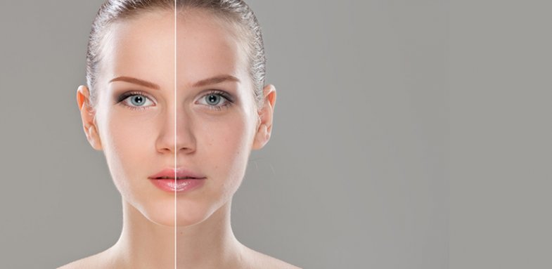 با این ۵ ماسک خانگی به جنگ جوش‌های صورت خود بروید
