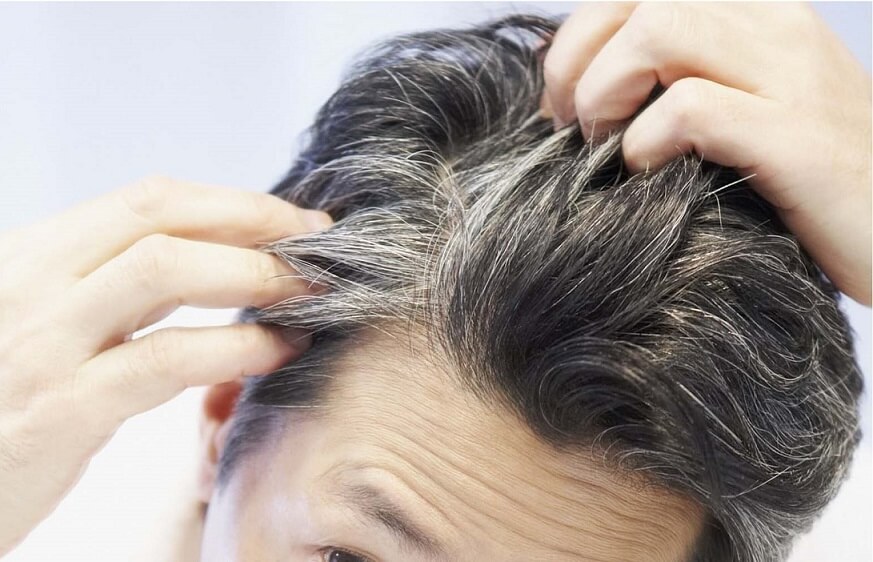 رژیم غذایی فوق العاده موثر برای جلوگیری از خاکستری شدن مو