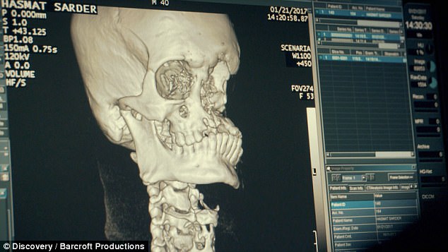  تلاش جراحان برای نجات مردی که ببر صورت او را نابود کرده است + تصاویر