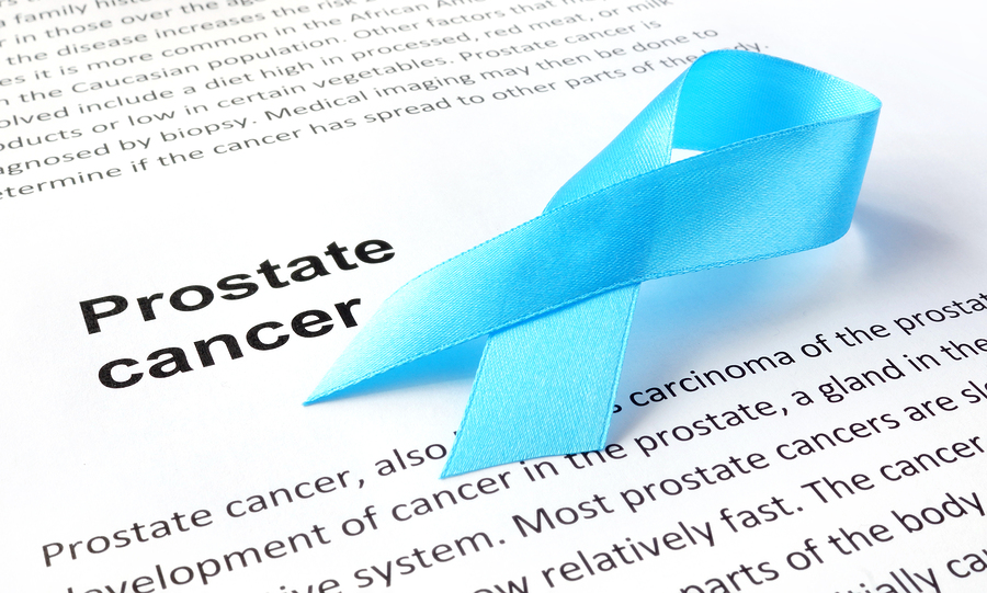  بررسی نشانه های یک سرطان مرگبار مردانه