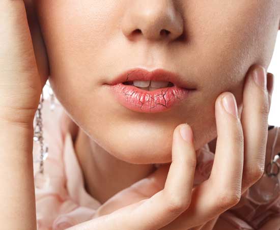  دلایل خشکی دهان چیست و چطور درمان می شود؟