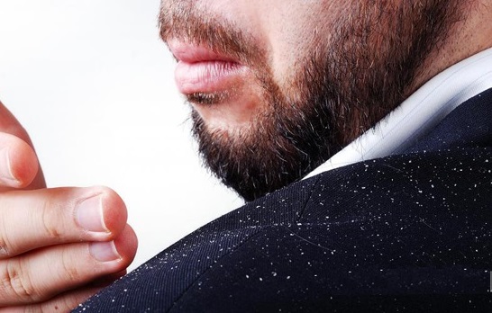  موثرترین راهکار‌های خانگی برای رفع شوره سر