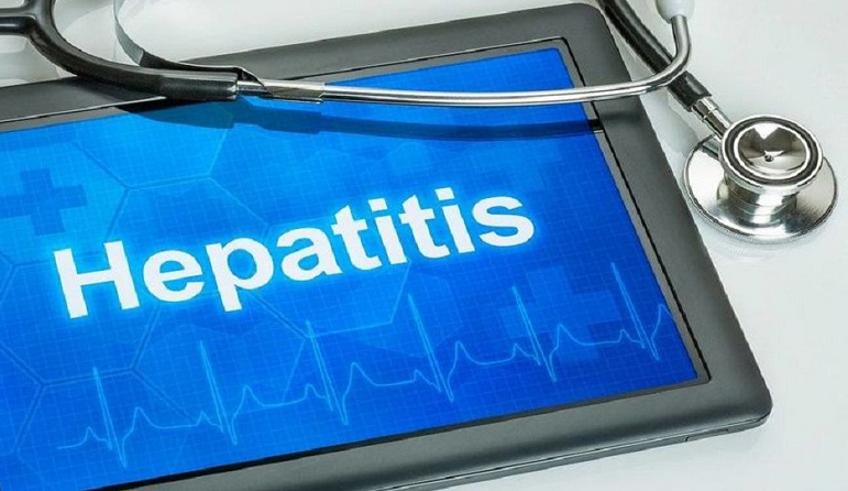 عللائم ونشانه های هپاتیت حاد