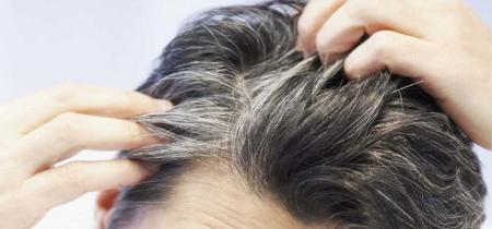  چرا سفیدی زودرس مو به سراغمان می آید؟