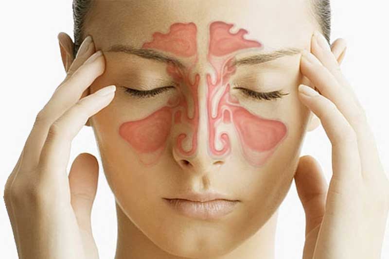 راه های پیشگیری از سینوزیت