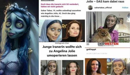 دختر ایرانی پس از 50 عمل زیبایی! + عکس