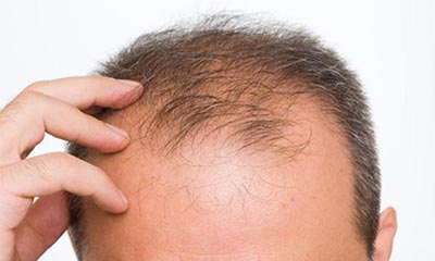 اینفوگرافیک/عادت هایی که موهایتان را کم‌ پُشت می‌کند