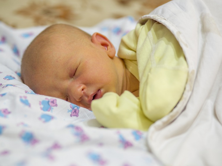 درمان زردی نوزاد در طب سنتی