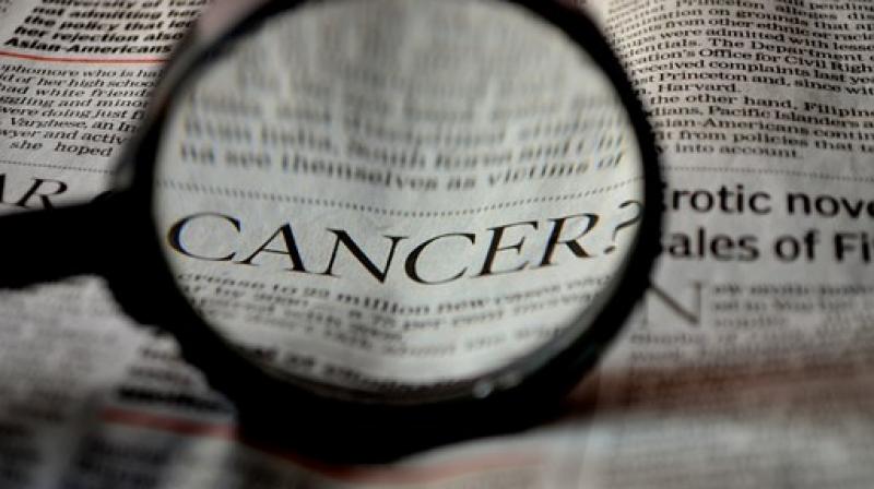 روش های جدید برای تشخیص سرطان های پنهان