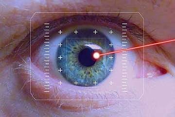 جراحی لیزیک چشم چگونه انجام می‌شود؟