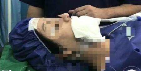 جراحی زنده در اینستاگرام برای جذب مشتری! +(تصاویر ۱‌۶‌‌ +‌)