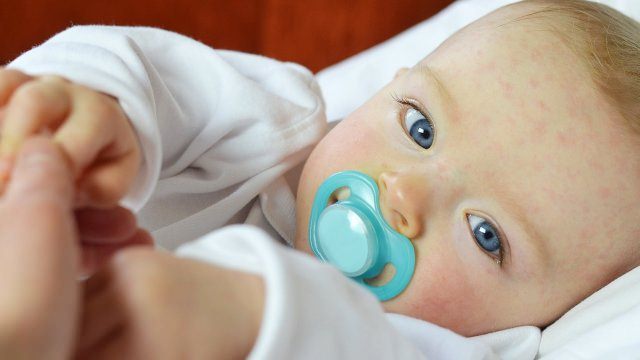 رگ خونی در مدفوع نوزاد خبر از چه بیماری می دهد؟