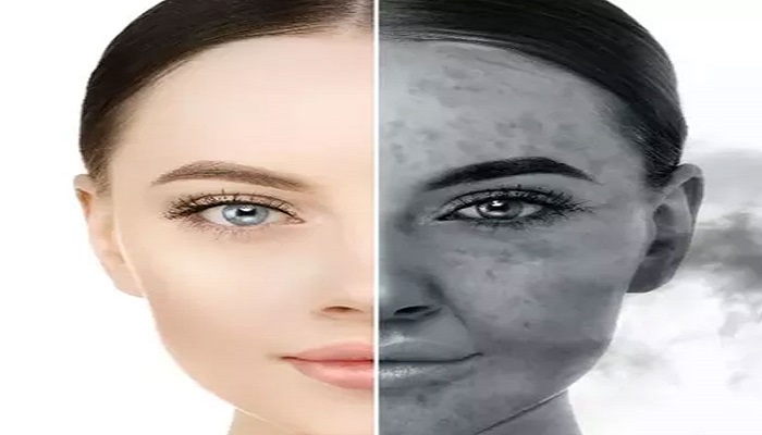 تاثیرات مخرب آلودگی هوا بر پوست شما