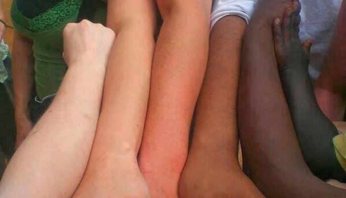 علت متفاوت بودن رنگ پوست انسان ها چیست ؟ 