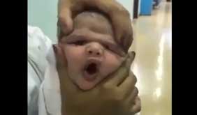 شکنجه نوزاد در بیمارستان توسط پرستار سنگدل + تصاویر
