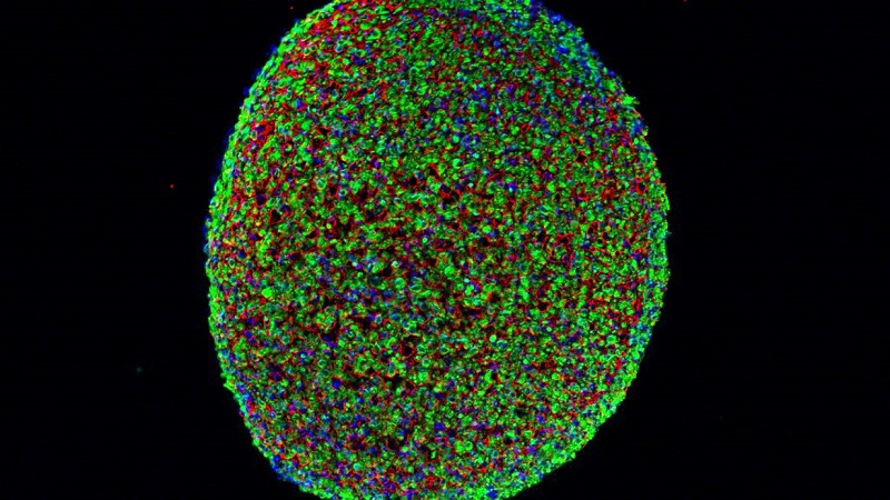 تولید بافت زنده و فعال پوست انسان با سلول‌های بنیادی