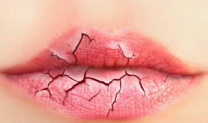 پیشگیری از خشک شدن لب‌ها در سرما